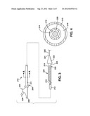 SPIRAL PERFUSION DILATATION BALLOON FOR USE IN VALVULOPLASTY PROCEDURE diagram and image