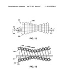 SPIRAL PERFUSION DILATATION BALLOON FOR USE IN VALVULOPLASTY PROCEDURE diagram and image