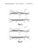 SLEEVE VALVE CATHETERS diagram and image