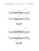 SLEEVE VALVE CATHETERS diagram and image