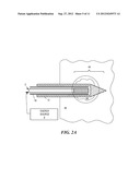 Cooled Laser Fiber for Improved Thermal Therapy diagram and image