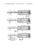 BALLOON CATHETER SYSTEM FOR TREATING VASCULAR OCCLUSIONS diagram and image