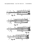 BALLOON CATHETER SYSTEM FOR TREATING VASCULAR OCCLUSIONS diagram and image