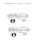 BALLOON CATHETER SYSTEM FOR TREATING VASCULAR OCCLUSIONS diagram and image