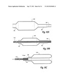 BALLOON CATHETER SYSTEM FOR TREATING VASCULAR OCCLUSIONS diagram and image
