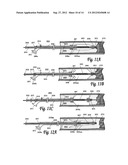 BALLOON CATHETER SYSTEM FOR TREATING VASCULAR OCCLUSIONS diagram and image