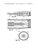 BALLOON CATHETER SYSTEM FOR TREATING VASCULAR OCCLUSIONS diagram and image