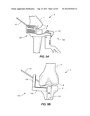 NAVIGATION AND POSITIONING SYSTEMS AND GUIDE INSTRUMENTS FOR JOINT REPAIR diagram and image