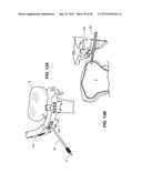 NAVIGATION AND POSITIONING SYSTEMS AND GUIDE INSTRUMENTS FOR JOINT REPAIR diagram and image