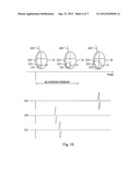 CARDIAC STIMULATING DEVICE diagram and image