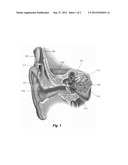 Wireless Audio Signal Monitor Output for Hearing Implant System diagram and image