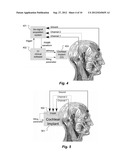 Post-Auricular Muscle Response Based Hearing Prosthesis Fitting diagram and image