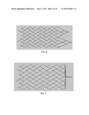 VASCULAR STENT WITH IMPROVED VESSEL WALL APPOSITION diagram and image