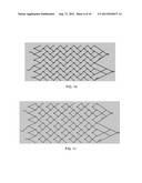 VASCULAR STENT WITH IMPROVED VESSEL WALL APPOSITION diagram and image