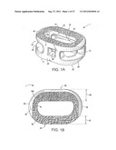 ENDPLATE-PRESERVING SPINAL IMPLANT WITH AN INTEGRATION PLATE HAVING     DURABLE CONNECTORS diagram and image