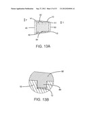 ENDPLATE-PRESERVING SPINAL IMPLANT WITH AN INTEGRATION PLATE HAVING     DURABLE CONNECTORS diagram and image