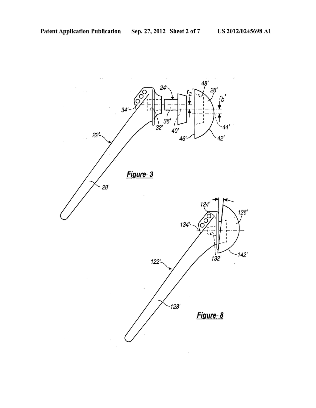 SHOULDER PROSTHESIS - diagram, schematic, and image 03