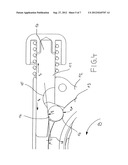 Locking device, in particular for prostheses diagram and image