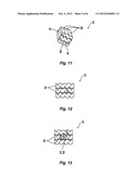 Starch Head Having a Stiffening Member diagram and image