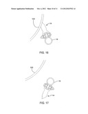 Conveyor Belt Cleaner Scraper Blade and Assembly diagram and image