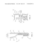 SYSTEM AND METHOD FOR DETECTING A LIKELIHOOD OF CORROSION diagram and image