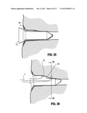 SURGICAL STAPLING DEVICE diagram and image