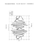 COMMON MODE HYSTERESIS FOR PULSE-WIDTH MODULATION DRIVES diagram and image