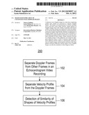 SHAPE BASED SIMILARITY OF CONTINUOUS WAVE DOPPLER IMAGES diagram and image