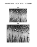 METHOD OF MEASURING PROGRESS OF ALOPECIA diagram and image