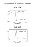 IMAGE PROCESSING APPARATUS, IMAGE PROCESSING METHOD, IMAGE PROCESSING     PROGRAM, AND VIRTUAL MICROSCOPE SYSTEM diagram and image