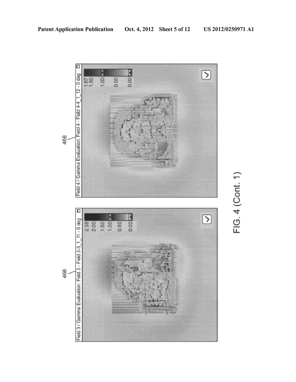 METHOD AND SYSTEM FOR AUTOMATED EVALUATION OF MULTIPLE PORTAL DOSE IMAGES     IN RADIATION THERAPY - diagram, schematic, and image 06