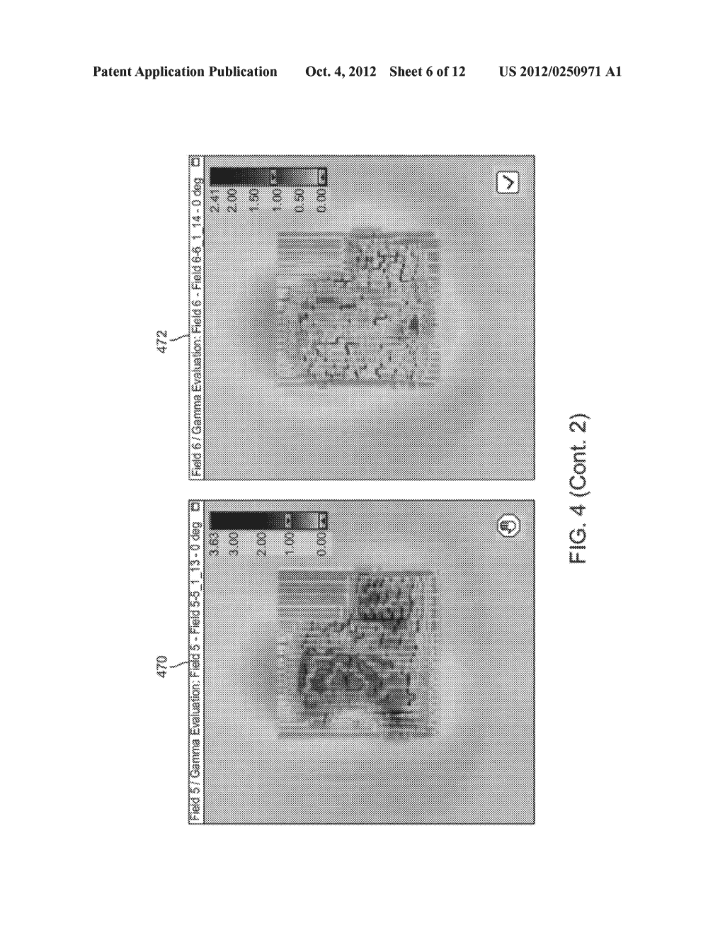 METHOD AND SYSTEM FOR AUTOMATED EVALUATION OF MULTIPLE PORTAL DOSE IMAGES     IN RADIATION THERAPY - diagram, schematic, and image 07