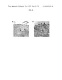 TARGETED DELIVERY OF THERAPEUTIC AGENTS WITH LYOPHILIZED MATRICES diagram and image