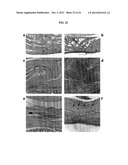 TARGETED DELIVERY OF THERAPEUTIC AGENTS WITH LYOPHILIZED MATRICES diagram and image