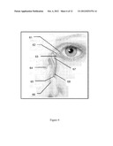 Treatment of Nasal and Sinus Disorders diagram and image
