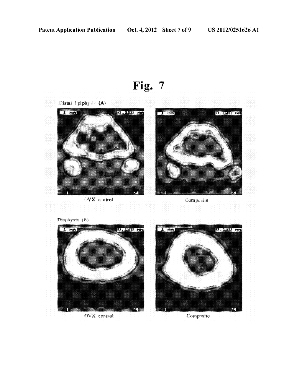 PROCESS FOR MANUFACTURING BIOCOMPATIBLE MATERIAL - diagram, schematic, and image 08