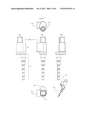 METHOD AND KIT FOR DENTAL IMPLANT DRILLING GUIDES diagram and image