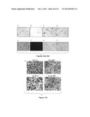 Materials and Methods Useful for Affecting Tumor Cell Growth, Migration     and Invasion diagram and image