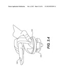 Magnetic Top System And Method diagram and image