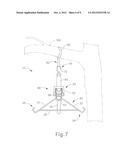 RATCHETING GAMBREL DEVICE diagram and image