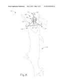 RATCHETING GAMBREL DEVICE diagram and image