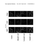 USE OF PHOSPHODIESTERASE INHIBITORS FOR TREATING MULTIDRUG RESISTANCE diagram and image