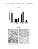 TIVOZANIB AND CAPECITABINE COMBINATION THERAPY diagram and image