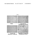 TIVOZANIB AND CAPECITABINE COMBINATION THERAPY diagram and image