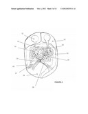 ORGAN RETRACTOR diagram and image