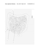 ORGAN RETRACTOR diagram and image