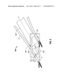 Single Incision Deployable Platform diagram and image