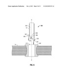 Single Incision Deployable Platform diagram and image