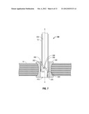 Single Incision Deployable Platform diagram and image