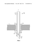 Single Incision Deployable Platform diagram and image